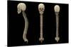 3D Rendering of Human Vertebral Column with Skull-Stocktrek Images-Stretched Canvas