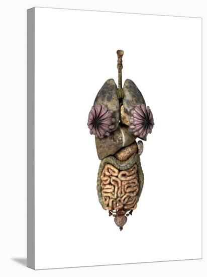 3D Rendering of Unhealthy Female Internal Organs-null-Stretched Canvas