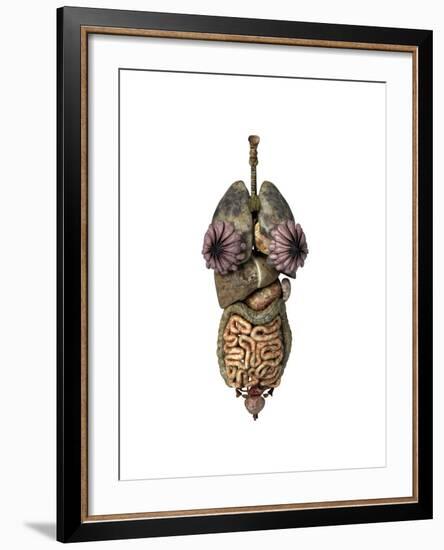 3D Rendering of Unhealthy Female Internal Organs-null-Framed Art Print