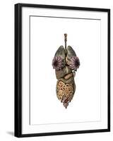 3D Rendering of Unhealthy Female Internal Organs-null-Framed Art Print