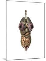 3D Rendering of Unhealthy Female Internal Organs-null-Mounted Art Print