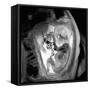 9 Month Foetus, MRI Scan-Du Cane Medical-Framed Stretched Canvas