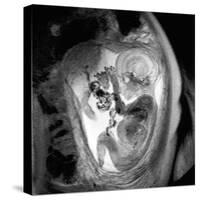9 Month Foetus, MRI Scan-Du Cane Medical-Stretched Canvas