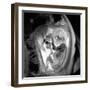 9 Month Foetus, MRI Scan-Du Cane Medical-Framed Photographic Print