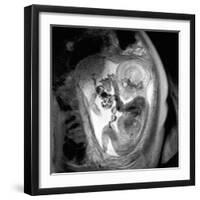 9 Month Foetus, MRI Scan-Du Cane Medical-Framed Photographic Print