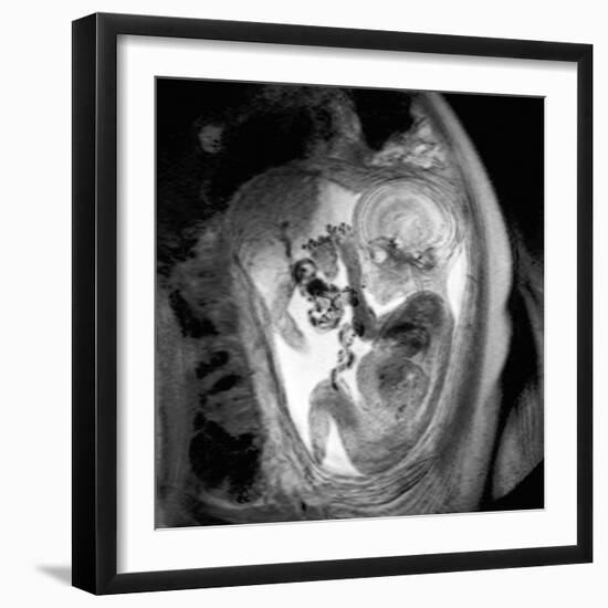 9 Month Foetus, MRI Scan-Du Cane Medical-Framed Photographic Print
