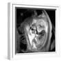 9 Month Foetus, MRI Scan-Du Cane Medical-Framed Photographic Print