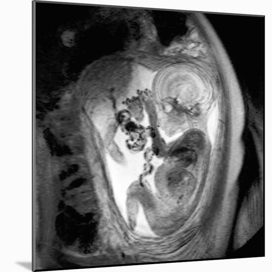 9 Month Foetus, MRI Scan-Du Cane Medical-Mounted Photographic Print