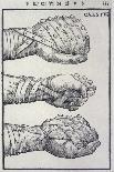 Detailed Views of a Roman Cestus a Leather Glove Used in Ancient Boxing-A. Forbes-Stretched Canvas