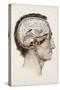 A Hand Coloured Lithograph of a Dissected Head in Profile Showing the Brain-Nicolas Henri Jacob-Stretched Canvas