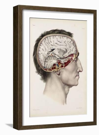 A Hand Coloured Lithograph of a Dissected Head in Profile Showing the Brain-Nicolas Henri Jacob-Framed Giclee Print