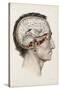 A Hand Coloured Lithograph of a Dissected Head in Profile Showing the Brain-Nicolas Henri Jacob-Stretched Canvas