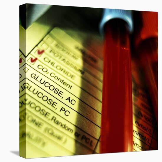 A Medical Test Checklist with Test Vials-null-Stretched Canvas