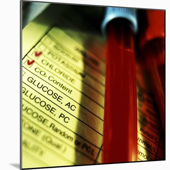 A Medical Test Checklist with Test Vials-null-Mounted Photographic Print