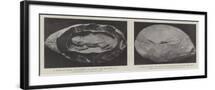 Black Frame