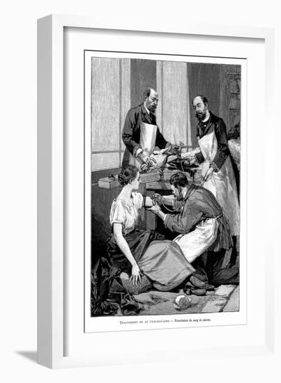 A Tuberculosis Patient Being Given a Transfusion of Goat's Blood, 1891-null-Framed Giclee Print