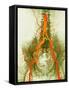 Abdominal Arteries, X-ray-null-Framed Stretched Canvas