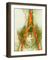 Abdominal Arteries, X-ray-null-Framed Photographic Print