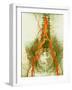 Abdominal Arteries, X-ray-null-Framed Photographic Print