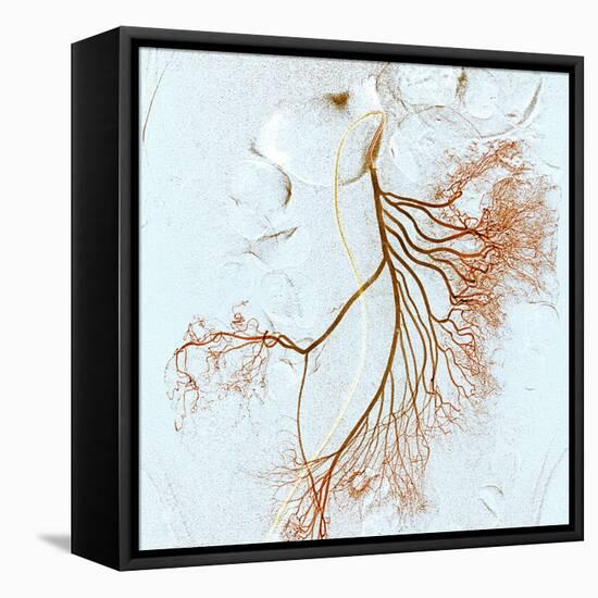 Abdominal Blood Vessels, X-ray-Du Cane Medical-Framed Stretched Canvas