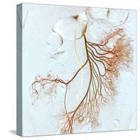 Abdominal Blood Vessels, X-ray-Du Cane Medical-Stretched Canvas