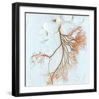 Abdominal Blood Vessels, X-ray-Du Cane Medical-Framed Premium Photographic Print