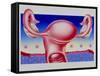 Abstract Artwork of Uterus, Pill & Menstrual Cycle-John Bavosi-Framed Stretched Canvas
