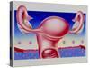 Abstract Artwork of Uterus, Pill & Menstrual Cycle-John Bavosi-Stretched Canvas
