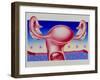 Abstract Artwork of Uterus, Pill & Menstrual Cycle-John Bavosi-Framed Photographic Print