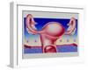 Abstract Artwork of Uterus, Pill & Menstrual Cycle-John Bavosi-Framed Photographic Print