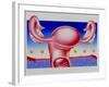 Abstract Artwork of Uterus, Pill & Menstrual Cycle-John Bavosi-Framed Photographic Print