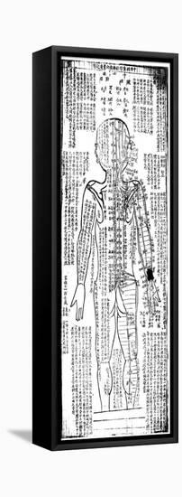 Acupuncture Chart for the Rear of the Body, Japanese, 19th Century-null-Framed Stretched Canvas