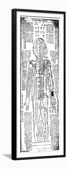 Acupuncture Chart for the Rear of the Body, Japanese, 19th Century-null-Framed Giclee Print