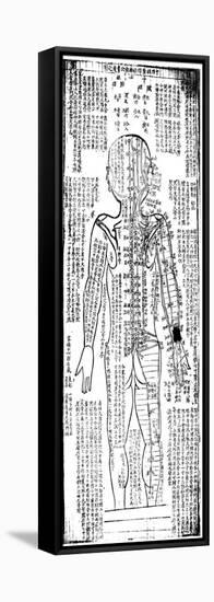 Acupuncture Chart for the Rear of the Body, Japanese, 19th Century-null-Framed Stretched Canvas
