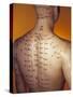 Acupuncture Model-Lawrence Lawry-Stretched Canvas