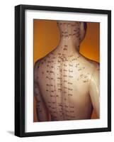 Acupuncture Model-Lawrence Lawry-Framed Photographic Print