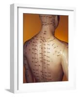 Acupuncture Model-Lawrence Lawry-Framed Photographic Print