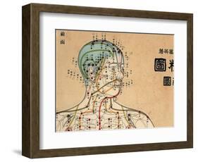 Acupuncture Points and Meridians of Human Body-null-Framed Giclee Print