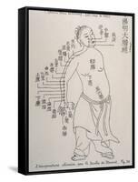 Acupuncture the Meridian of the Large Intestine-null-Framed Stretched Canvas