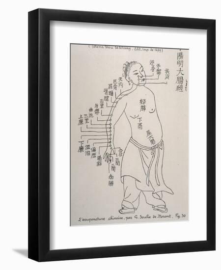 Acupuncture the Meridian of the Large Intestine-null-Framed Art Print