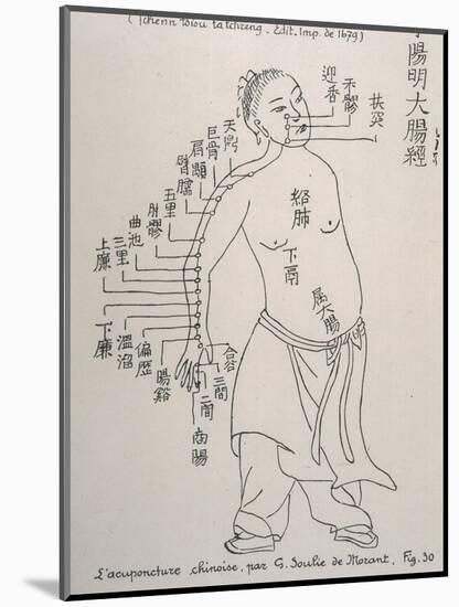 Acupuncture the Meridian of the Large Intestine-null-Mounted Art Print