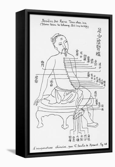 Acupuncture the Meridian of the Loins-Tchenn Tsiou Ta-tcheng-Framed Stretched Canvas