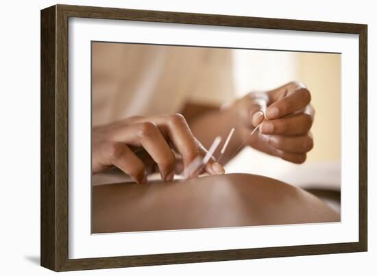 Acupuncture-Adam Gault-Framed Photographic Print