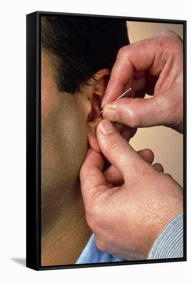 Acupuncturist's Hands Insert Needle Into Man's Ear-Damien Lovegrove-Framed Stretched Canvas