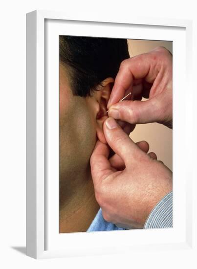 Acupuncturist's Hands Insert Needle Into Man's Ear-Damien Lovegrove-Framed Photographic Print