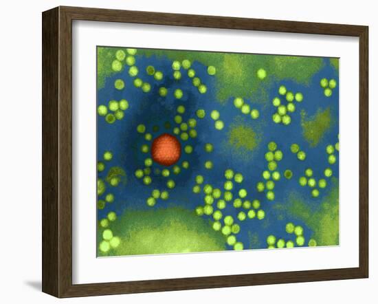 Adeno-associated Virus, TEM-Dr. Linda Stannard-Framed Photographic Print