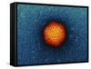 Adenovirus Particle, TEM-Dr. Klaus Boller-Framed Stretched Canvas