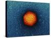 Adenovirus Particle, TEM-Dr. Klaus Boller-Stretched Canvas