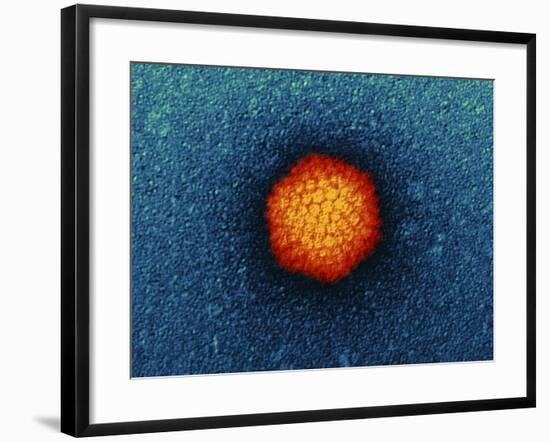 Adenovirus Particle, TEM-Dr. Klaus Boller-Framed Photographic Print