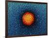 Adenovirus Particle, TEM-Dr. Klaus Boller-Framed Photographic Print